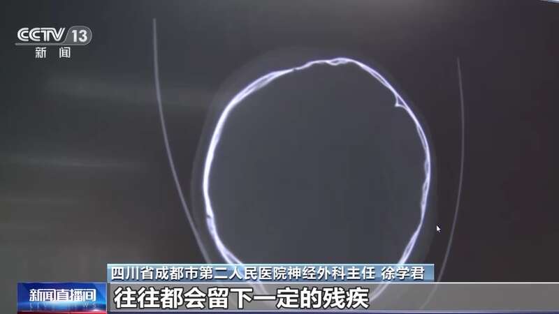 BOB半岛·(中国)官方网站骑行人注意！头盔“新国标”来了AB盔要分清→(图4)